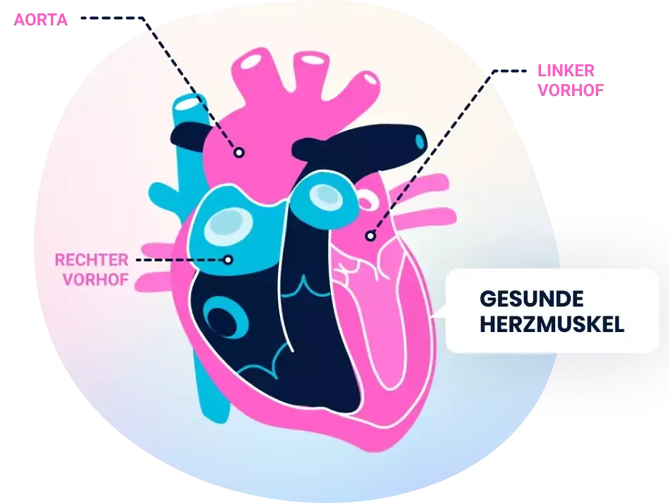 Heart illustration showing normal heart