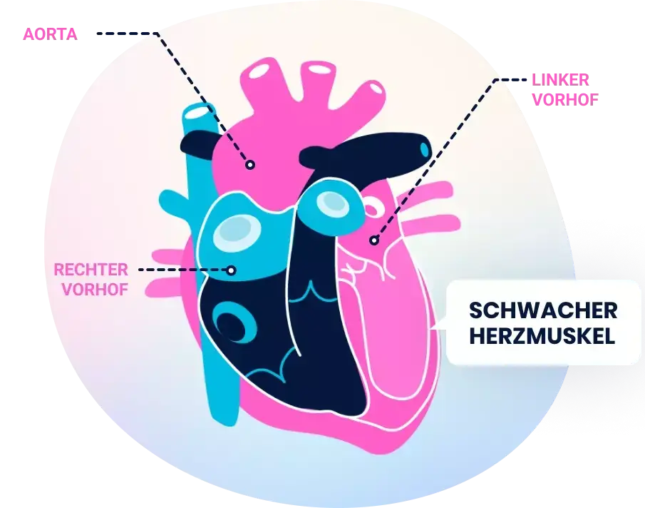 Heart illustration showing heart failure results